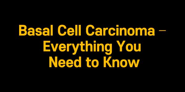 Basal Cell Carcinoma – Everything You Need to Know